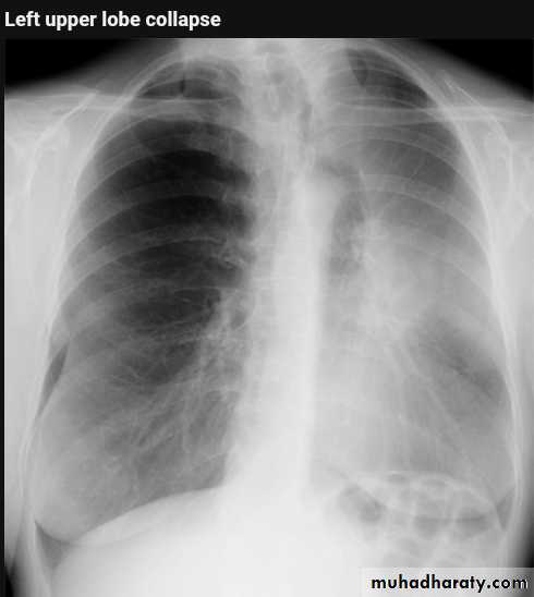 Chest Imaging