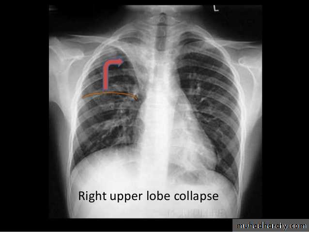 Chest Imaging