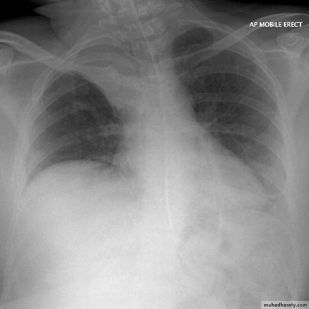 Chest Imaging