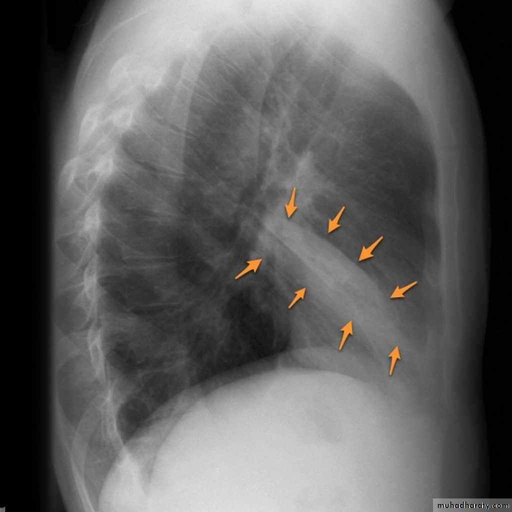 Chest Imaging