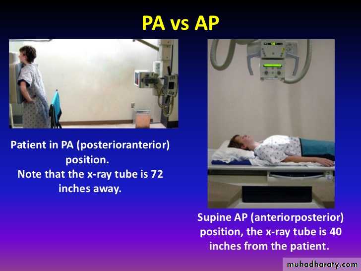 Chest Imaging