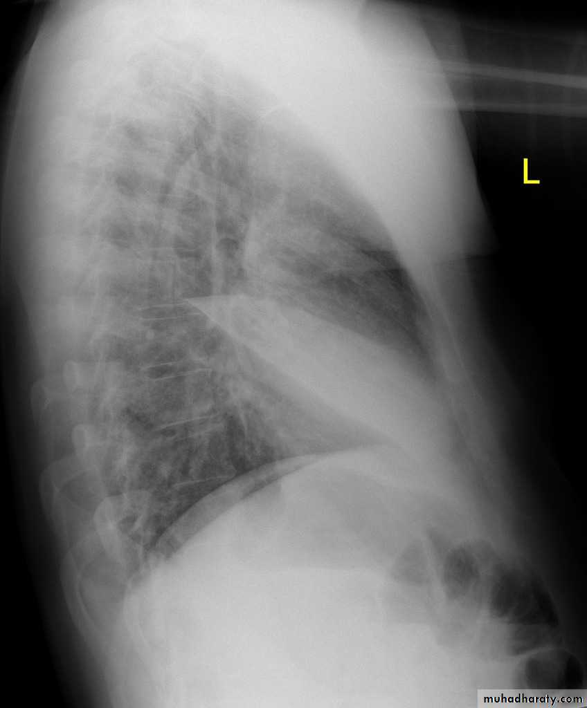 Chest Imaging