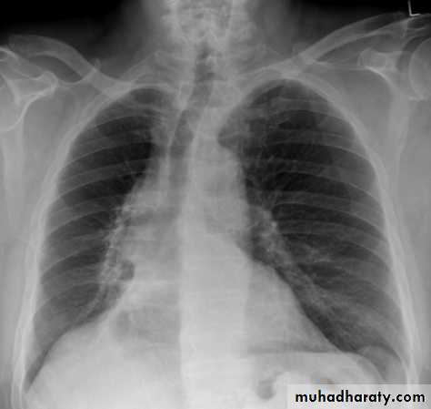 Chest Imaging