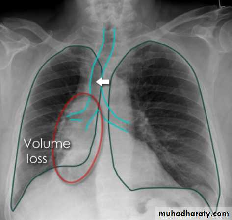 Chest Imaging