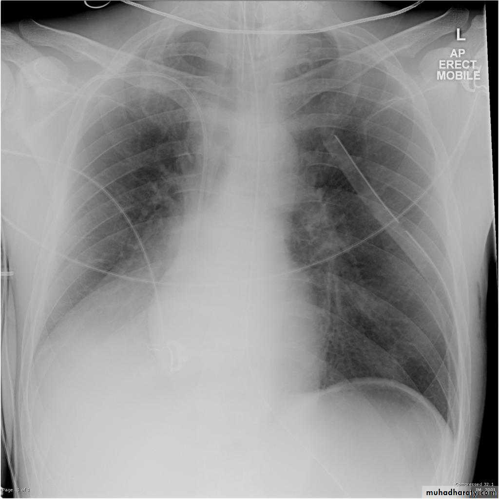 Chest Imaging