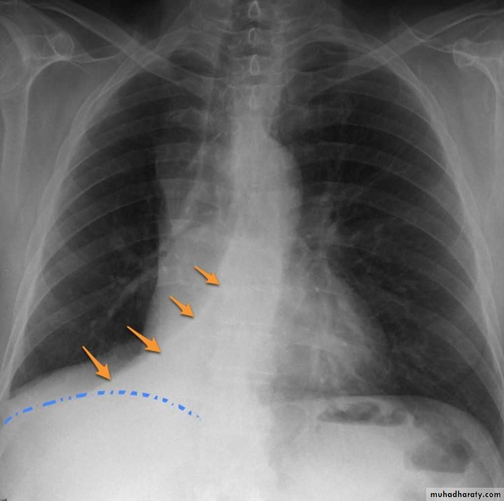 Chest Imaging