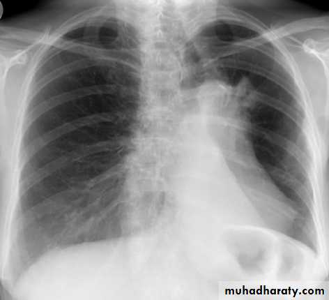 Chest Imaging