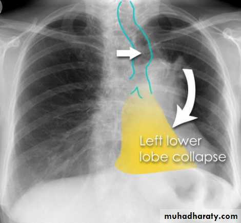 Chest Imaging