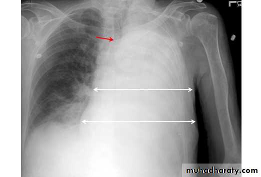 Chest Imaging