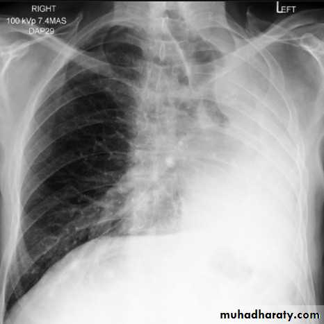 Chest Imaging