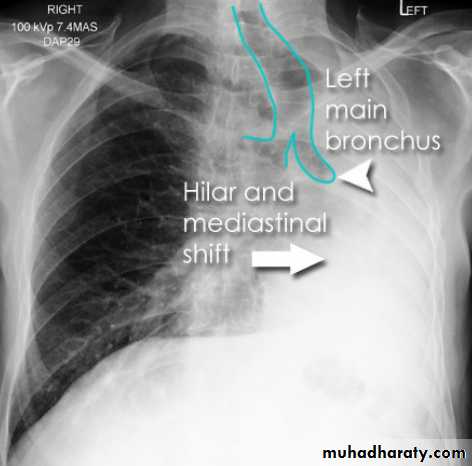 Chest Imaging