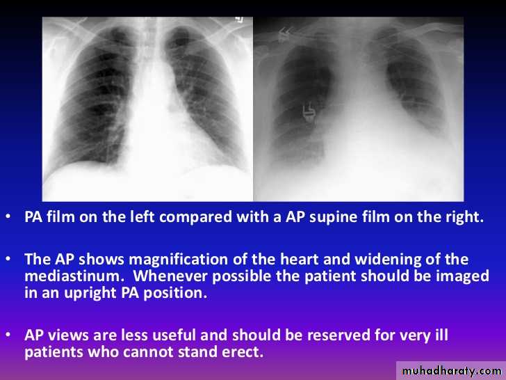 Chest Imaging