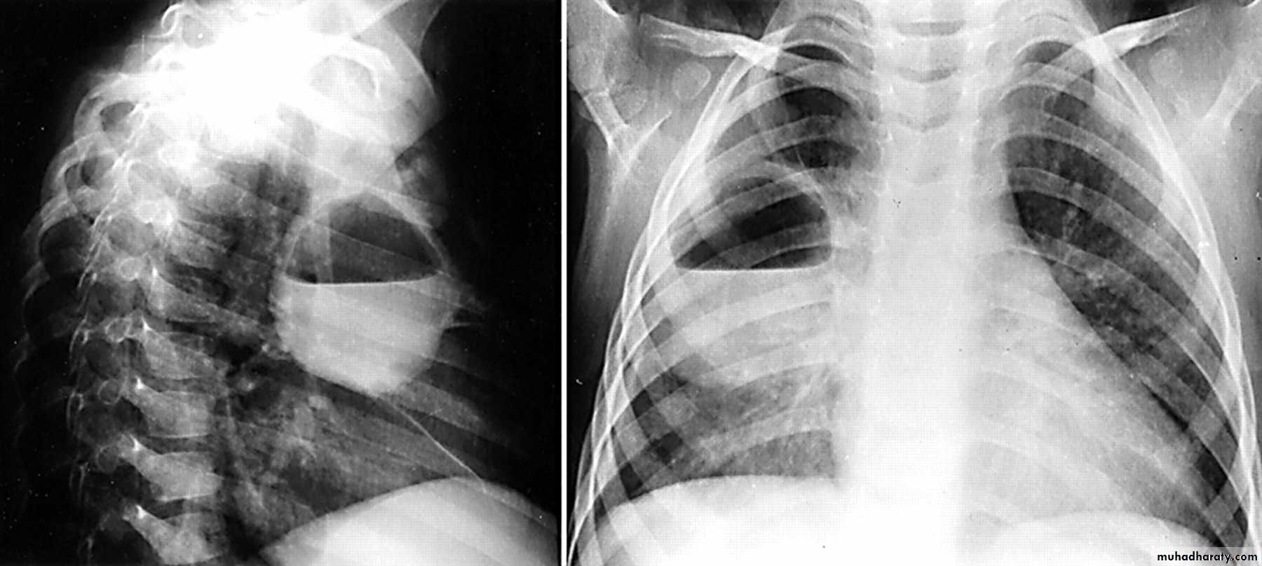 Chest Imaging