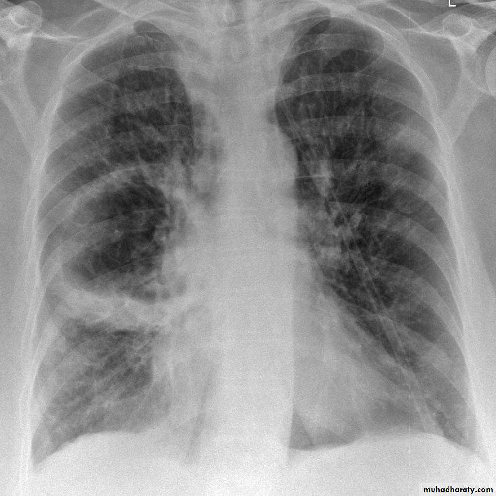 Chest Imaging