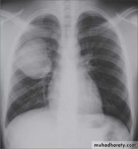 Chest Imaging
