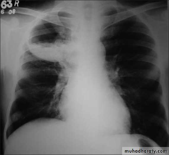 Chest Imaging