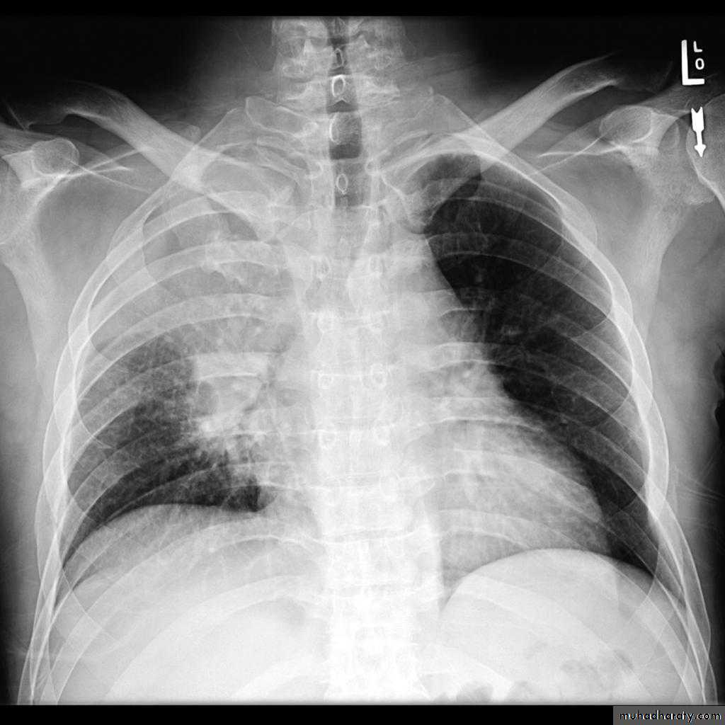 Chest Imaging