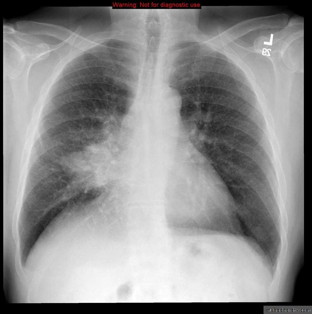 Chest Imaging