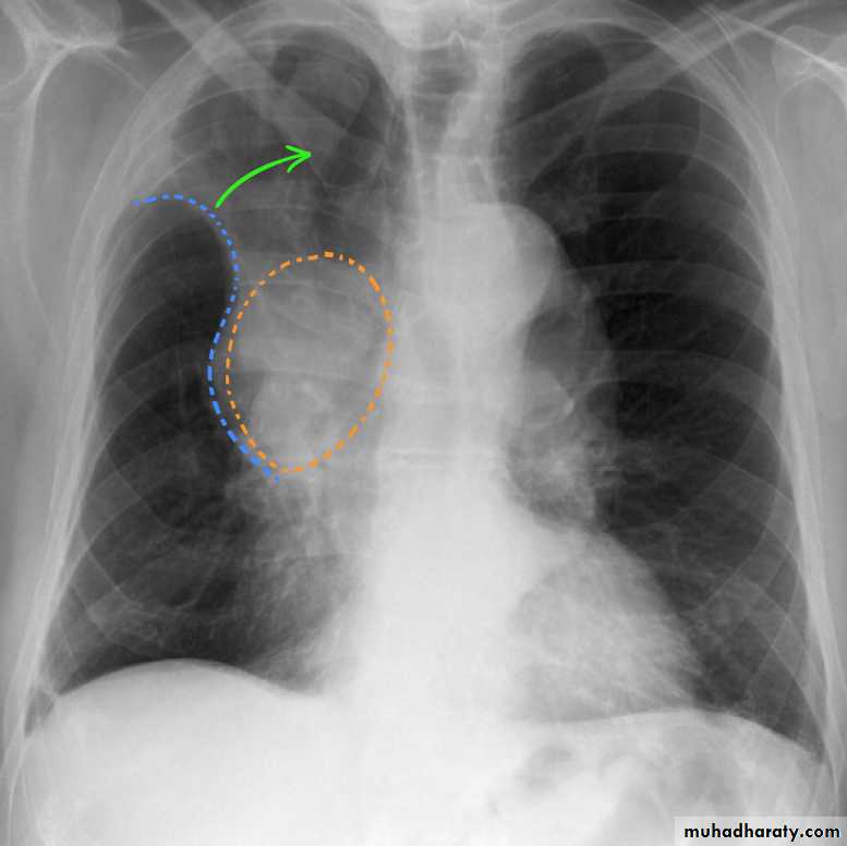 Chest Imaging
