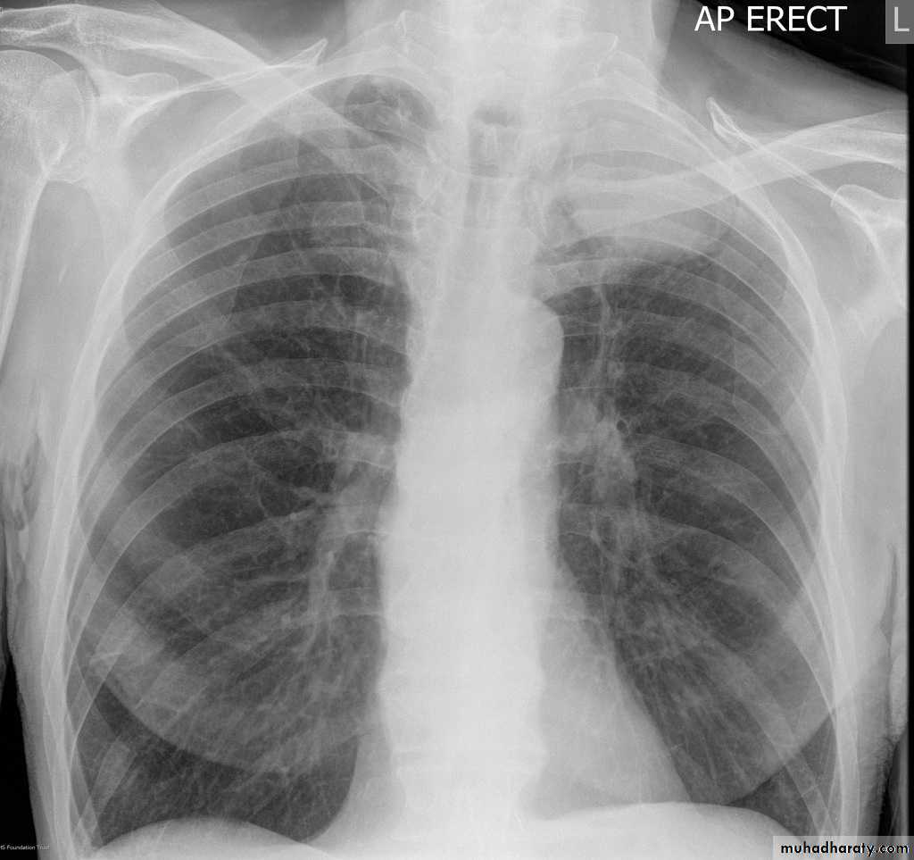 Chest Imaging