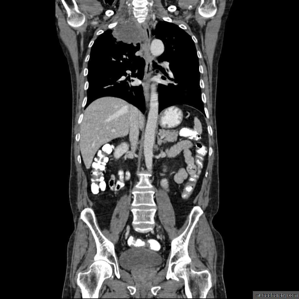 Chest Imaging