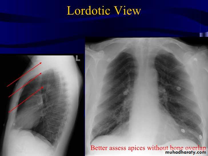 Chest Imaging