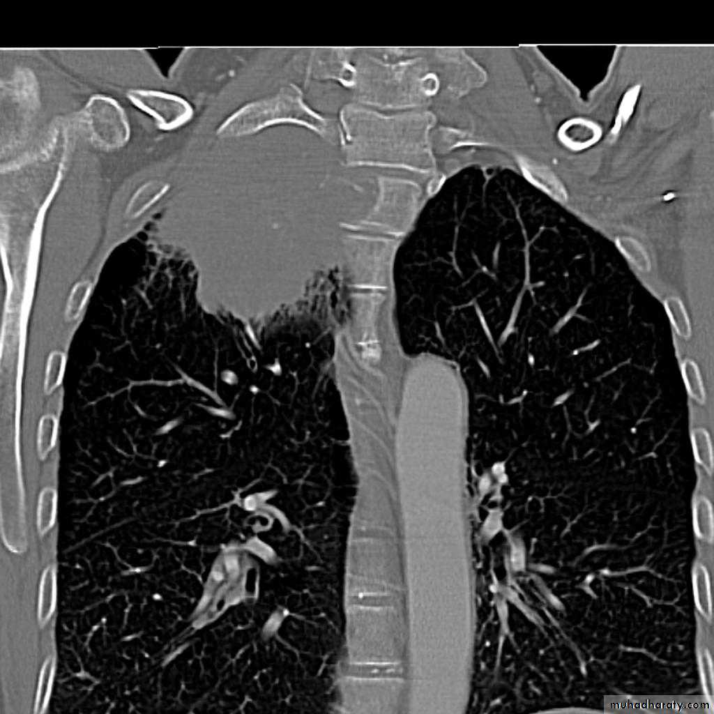 Chest Imaging