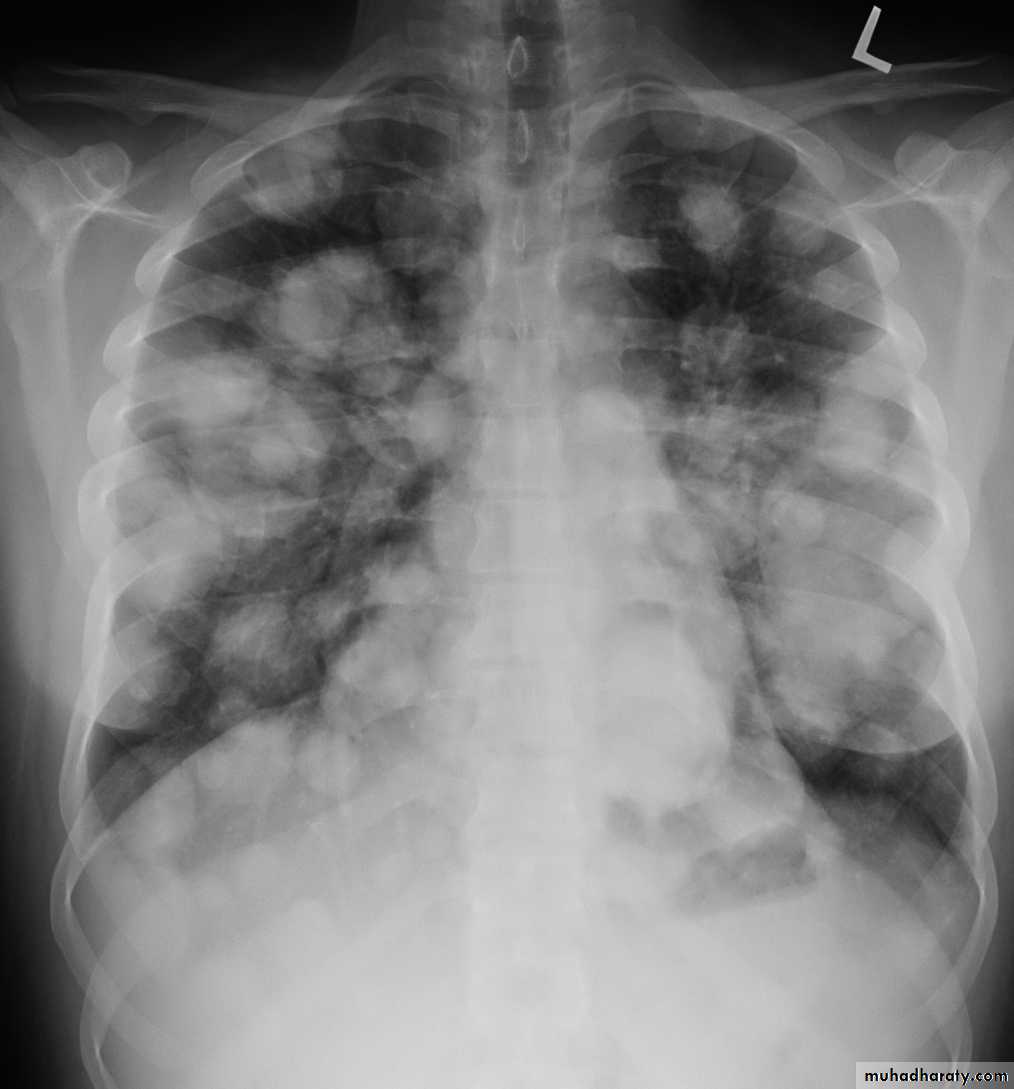 Chest Imaging