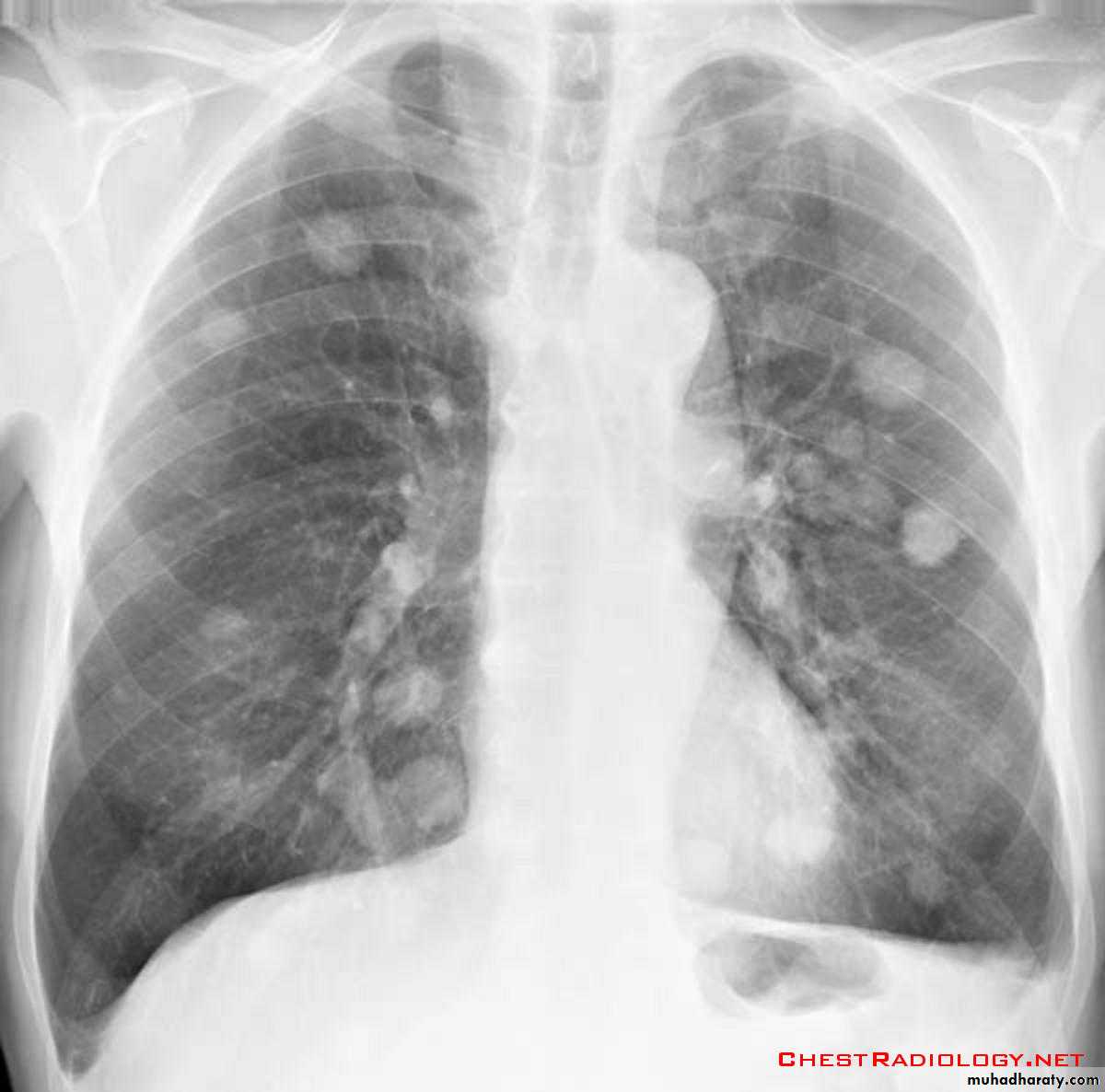Chest Imaging