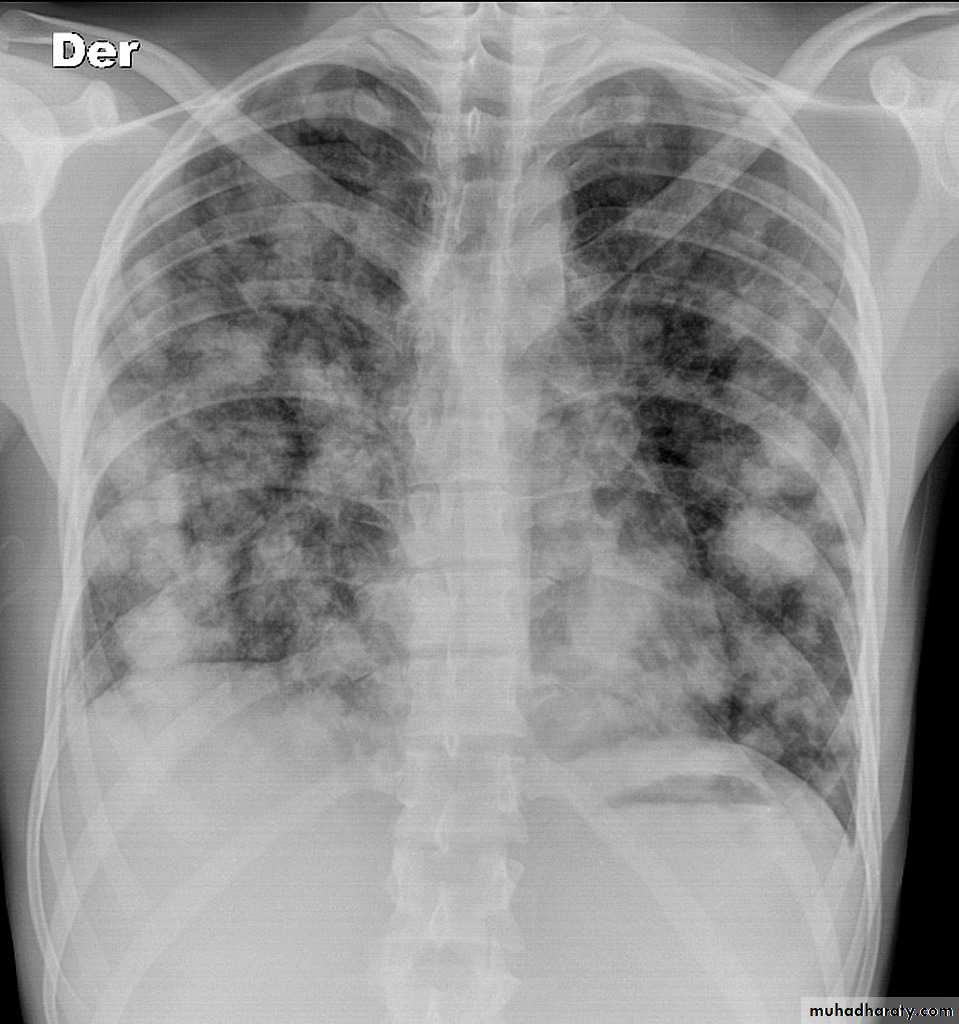 Chest Imaging
