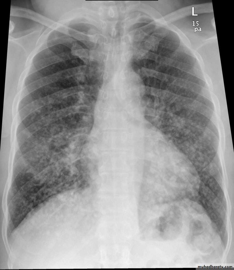 Chest Imaging