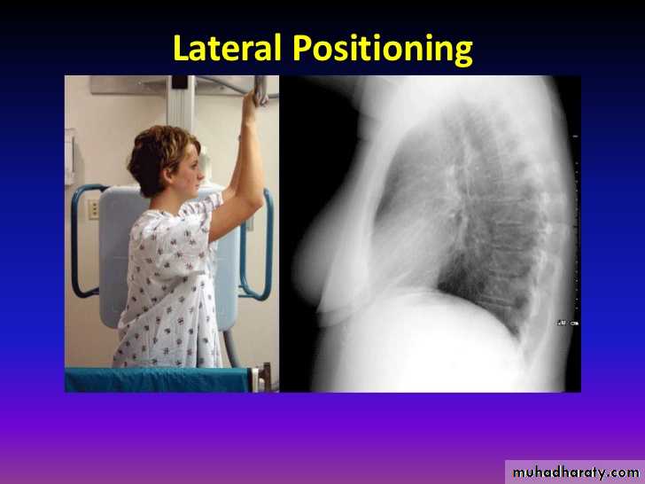 Chest Imaging
