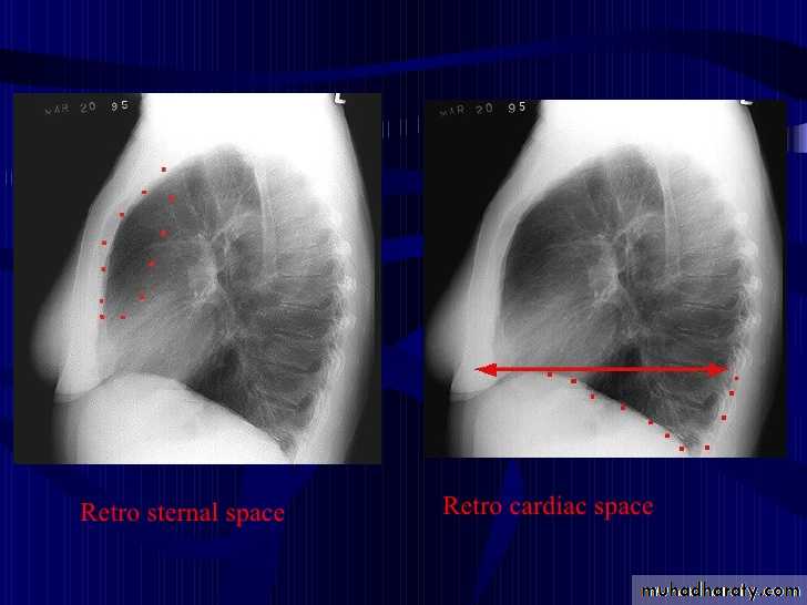 Chest Imaging