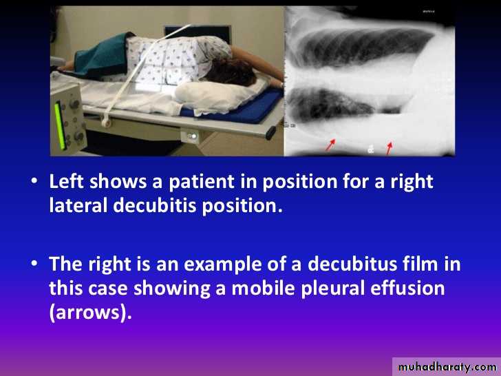 Chest Imaging