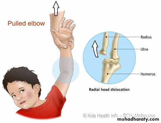Upper Limb Orthopedic