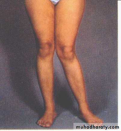 Diagnosis in Orthopedics