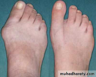 Diagnosis in Orthopedics