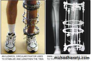 Diagnosis in Orthopedics