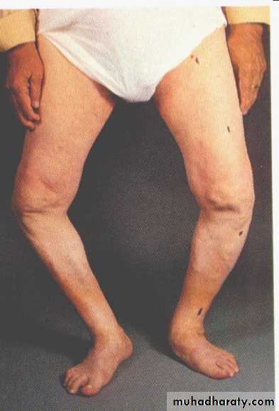 Diagnosis in Orthopedics