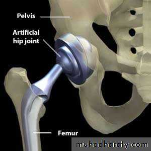 Diagnosis in Orthopedics