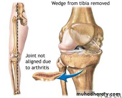 Diagnosis in Orthopedics