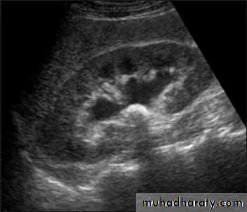 UltraSound