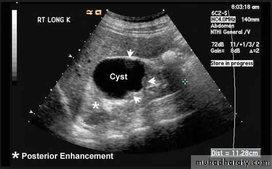 UltraSound