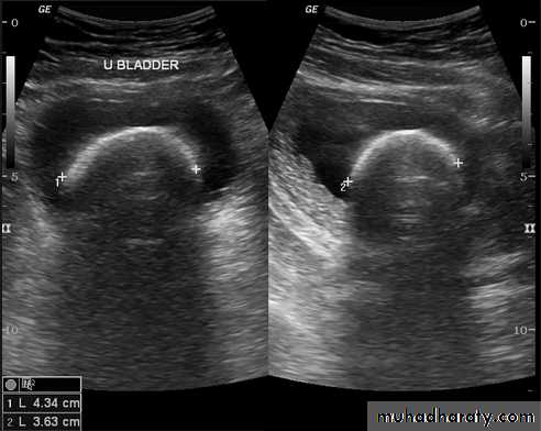 UltraSound