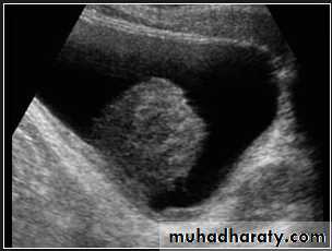 UltraSound