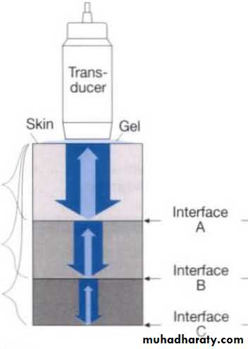 UltraSound