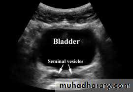 UltraSound