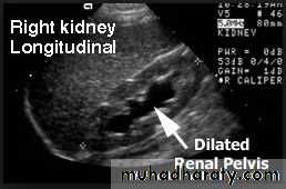 UltraSound