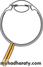 Lectures of Ophthalmology