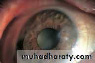 Lectures of Ophthalmology
